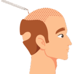 High-End Aesthetic Treatments in Bogotá